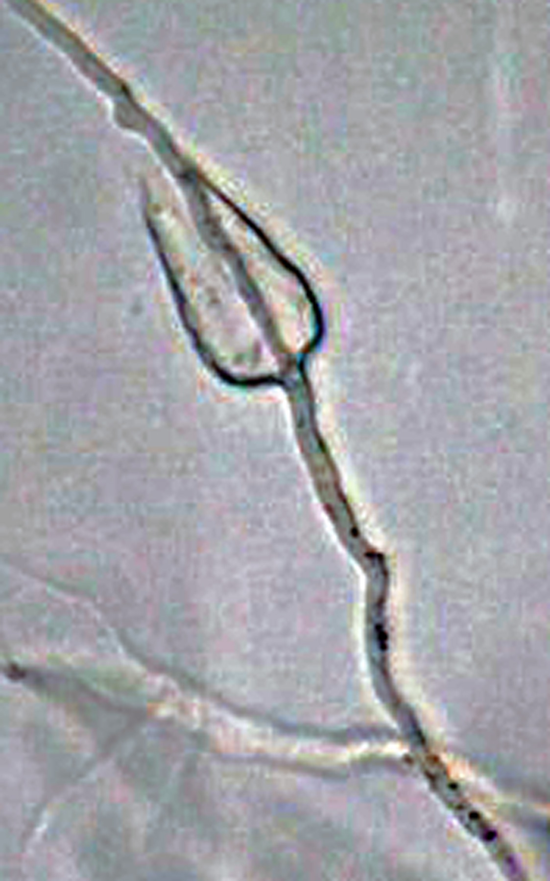   Phytophthora lilii nbsp;(ex-type CBS 135746) asexual phase:nbsp;internal proliferation ofnbsp;sporangium; photos by Koji Kageyama and Mohammad Z. Rahman Gifu University, Japan. 

