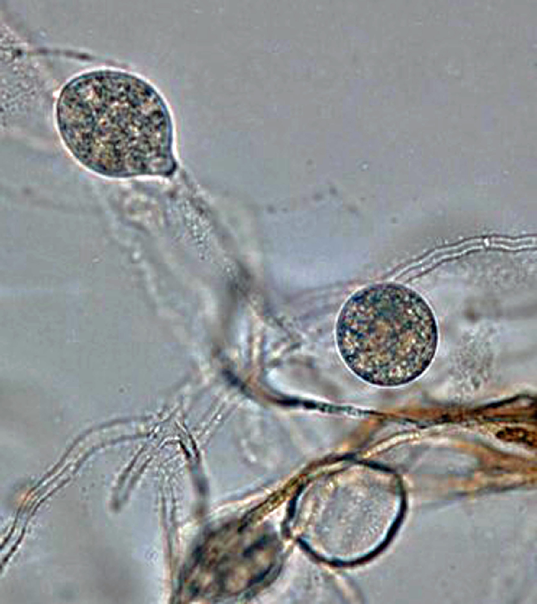   Phytophthora lilii nbsp;(ex-type CBS 135746) asexual phase:nbsp;globose chlamydospores; photonbsp;by Koji Kageyama and Mohammad Z. Rahman Gifu University, Japan. 
