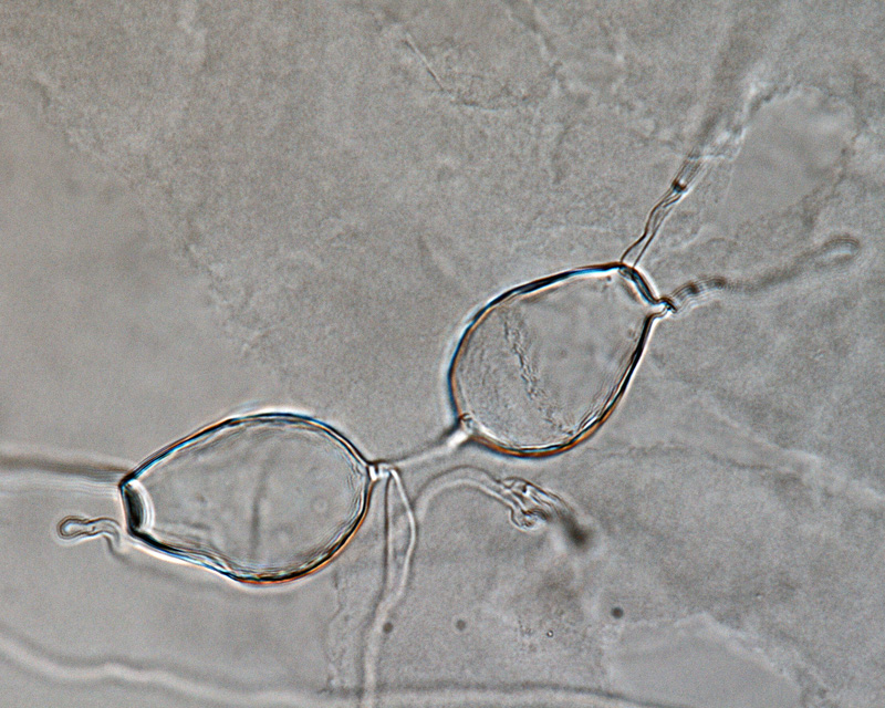   Phytophthora multivesiculata nbsp;(CPHST BL 50G, ex-type) asexual phase: persistent nonpapillate sporangia with external proliferation; photonbsp;by Gloria Abad, USDA-APHIS-PPQ. 
