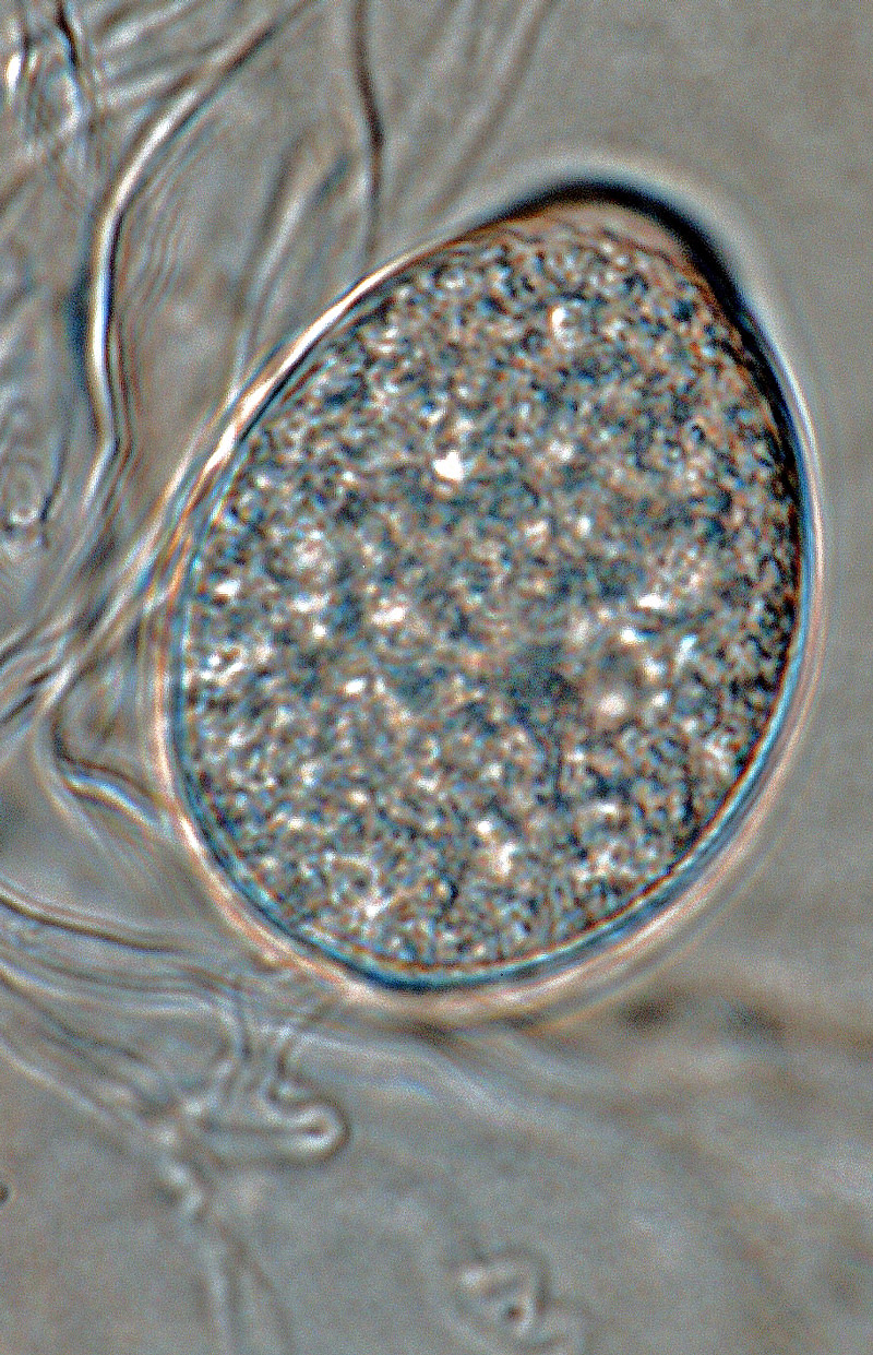   Phytophthora multivesiculata nbsp;(CPHST BL 50G, ex-type) asexual phase: persistent nonpapillate sporangium; photonbsp;by Gloria Abad, USDA-APHIS-PPQ. 
