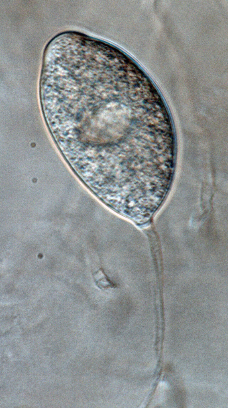   Phytophthora multivesiculata nbsp;(CPHST BL 50G, ex-type) asexual phase: persistent nonpapillate sporangium; photonbsp;by Gloria Abad, USDA-APHIS-PPQ. 
