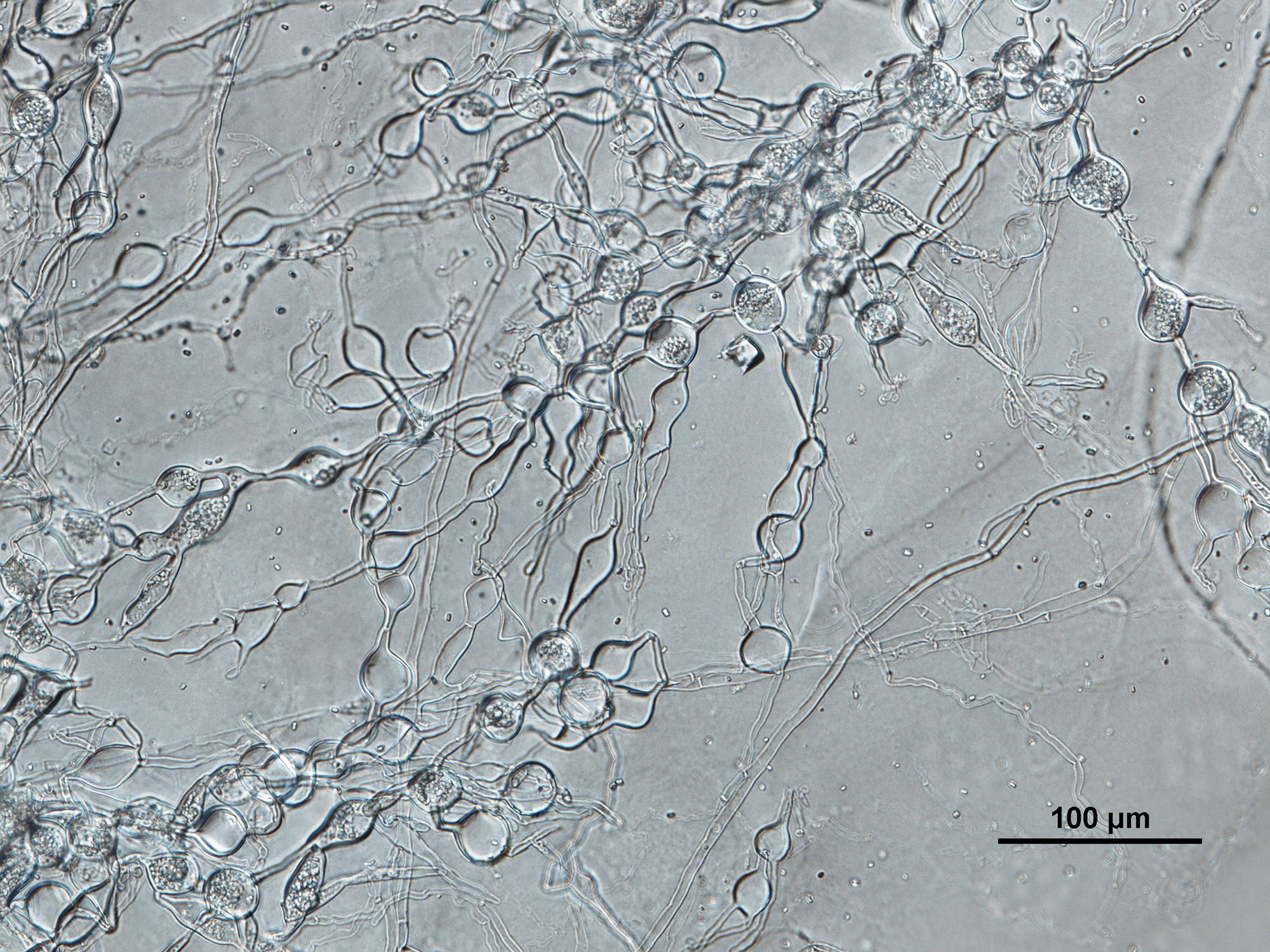   Phytophthora multivesiculata nbsp;(CPHST BL 50G, ex-type) asexual phase: globose and catenulate hyphal swellings; photonbsp;by Gloria Abad, USDA-APHIS-PPQ. 
