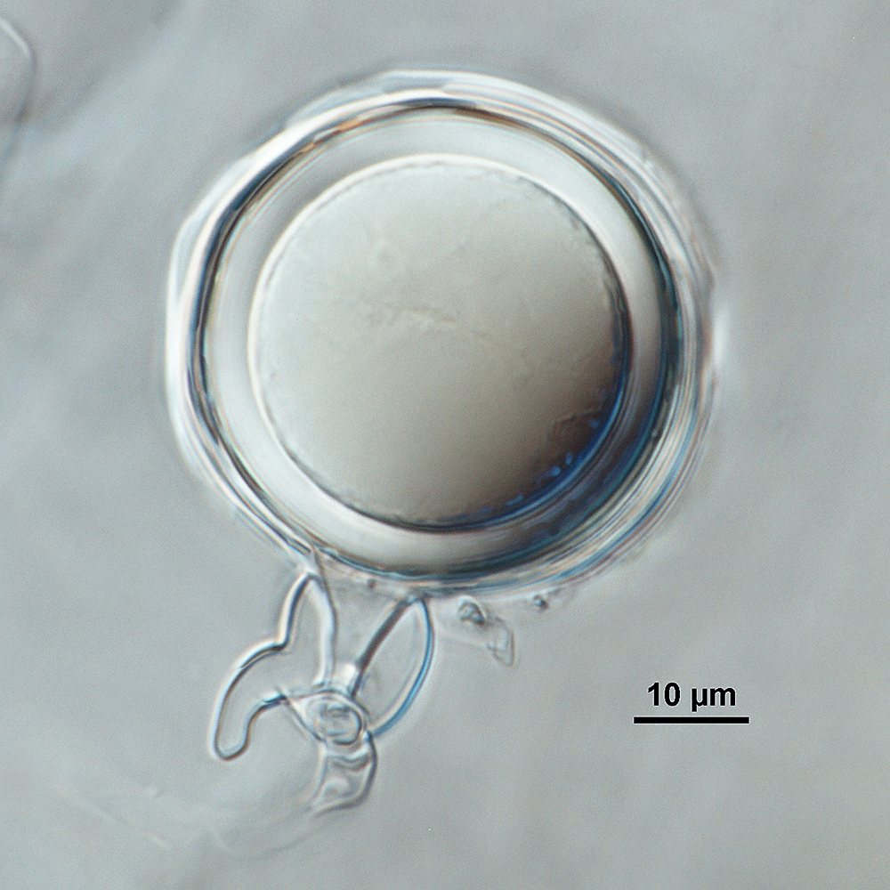   Phytophthora multivesiculata nbsp;(CPHST BL 50G, ex-type) sexual phase:nbsp;plerotic oosporenbsp;withnbsp;predominantlynbsp;amphigynous antheridium with digitate projection; photonbsp;by Gloria Abad, USDA-APHIS-PPQ. 

