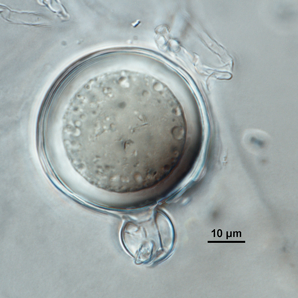   Phytophthora multivesiculata nbsp;(CPHST BL 50G, ex-type) sexual phase:nbsp;plerotic oosporenbsp;withnbsp;predominantlynbsp;amphigynous antheridium with small digitate projection; photonbsp;by Gloria Abad, USDA-APHIS-PPQ. 
