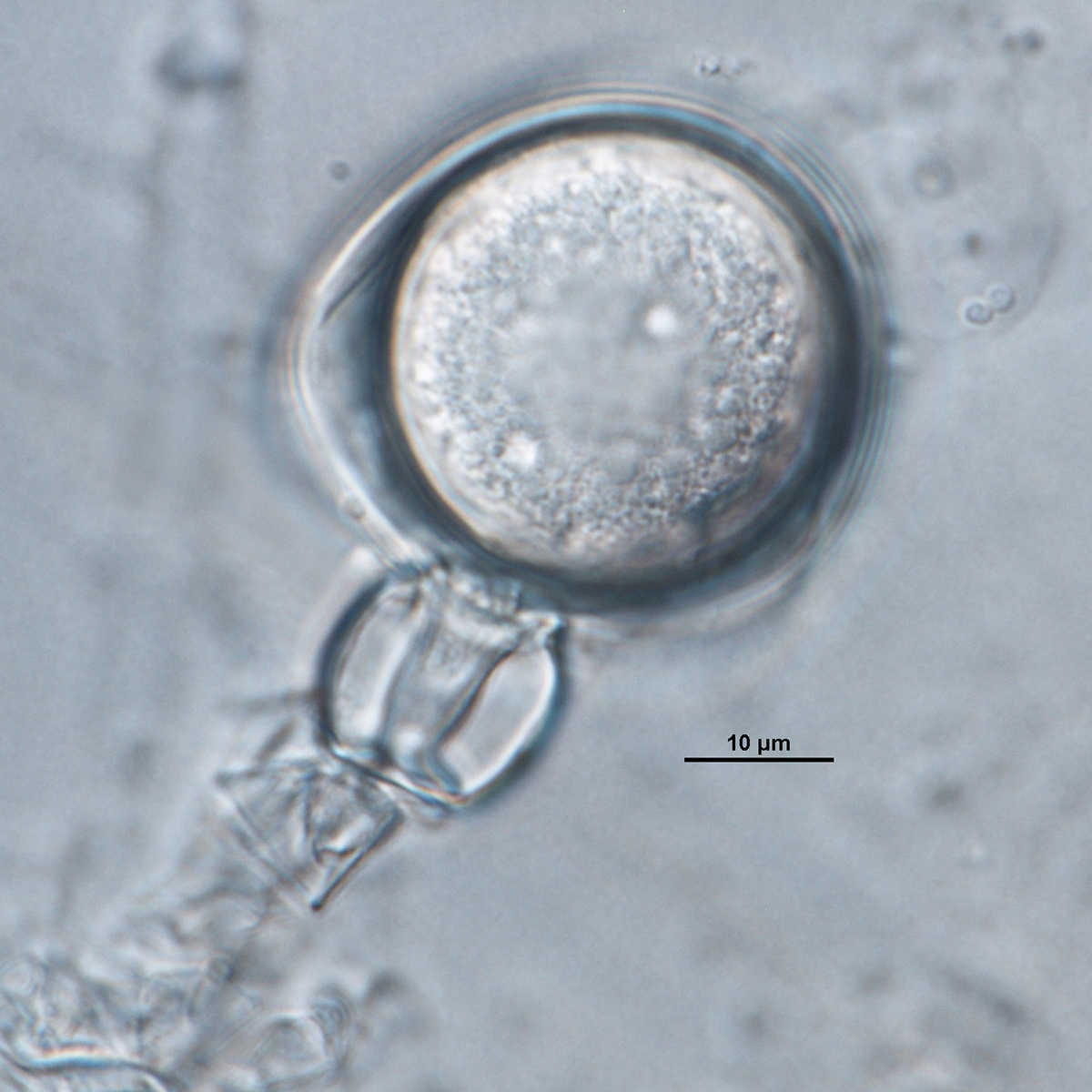   Phytophthora nemorosa nbsp;(CPHST BL 27) sexual phase:nbsp;showing oogoniumnbsp;smooth-walled, amphyginous antheridium, and aplerotic oospore; photo bynbsp;Gloria Abad. 
