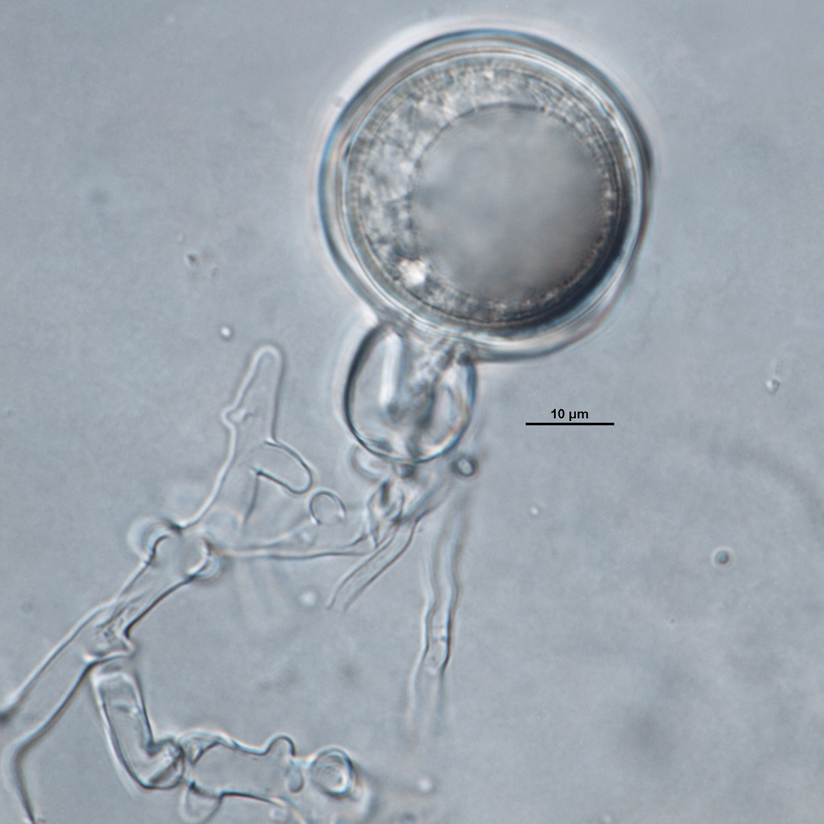   Phytophthora nemorosa nbsp;(CPHST BL 27) sexual phase:nbsp;showing oogoniumnbsp;smooth-walled, amphyginous antheridium, and aplerotic oospore; photo bynbsp;Gloria Abad. 
