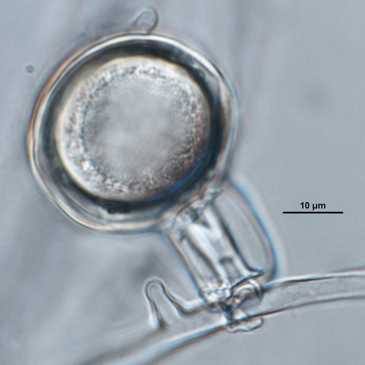   Phytophthora nemorosa nbsp;(CPHST BL 27) sexual phase:nbsp;showing oogoniumnbsp;smooth-walled, amphyginous antheridium, and aplerotic oospore; photo bynbsp;Gloria Abad. 
