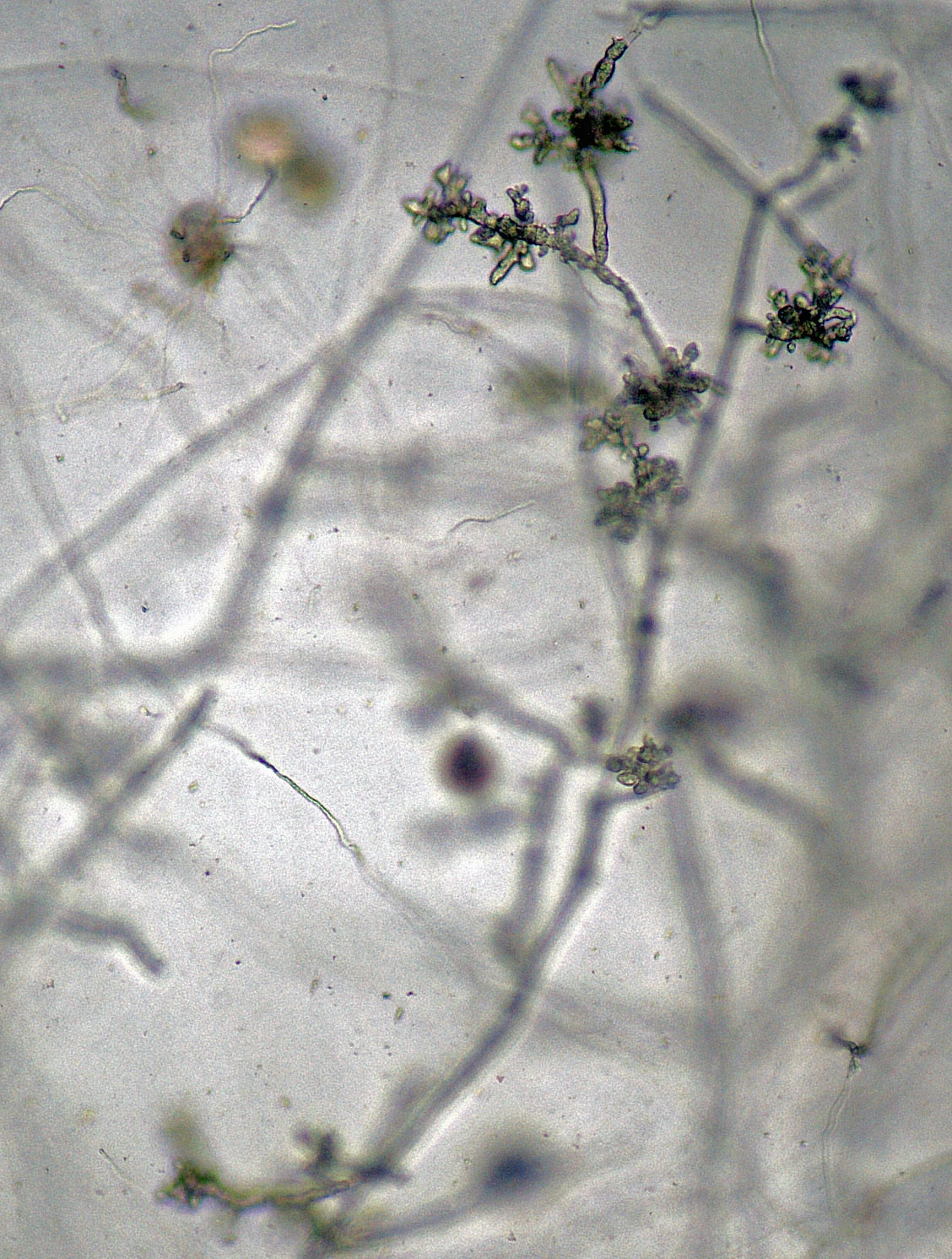   Phytophthora nicotianae  (CPHST BL 44, selected specimen) asexual phase: hyphal swellings; photonbsp;by Gloria Abad, USDA-APHIS-PPQ. 
