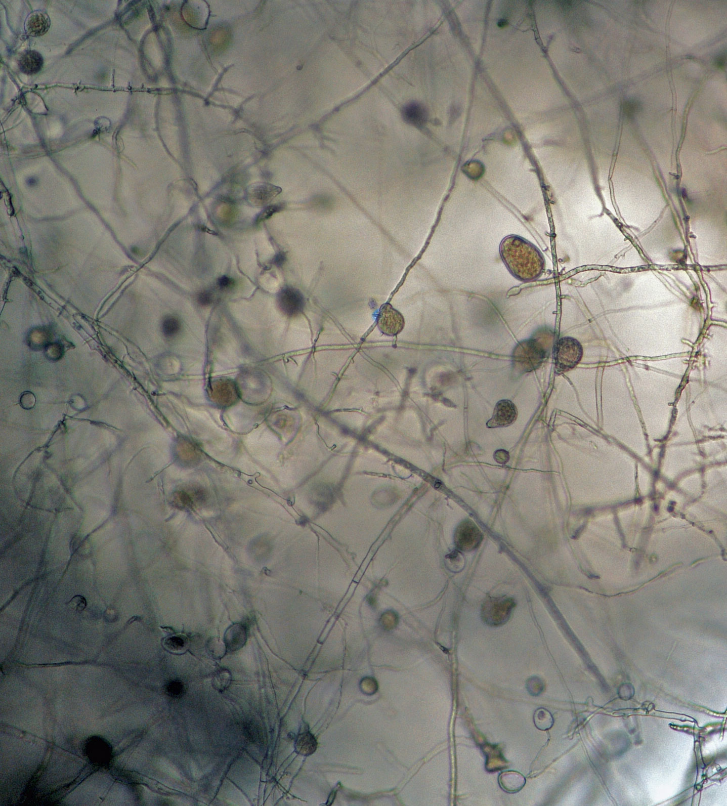   Phytophthora nicotianae nbsp;(CPHST BL 44, selected specimen) asexual phase: sporangia originated in simple sympodial sporangiophores; photonbsp;by Gloria Abad, USDA-APHIS-PPQ. 
