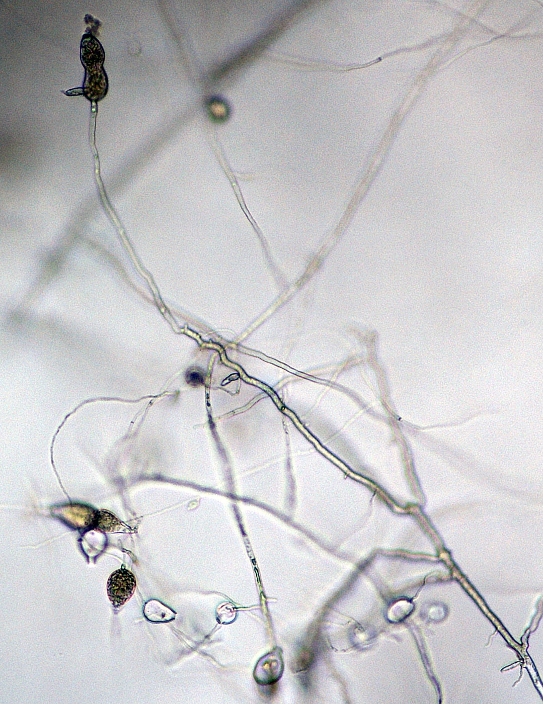   Phytophthora nicotianae nbsp;(CPHST BL 44, selected specimen) asexual phase: sporangia originated in simple sympodial sporangiophores; photonbsp;by Gloria Abad, USDA-APHIS-PPQ. 
