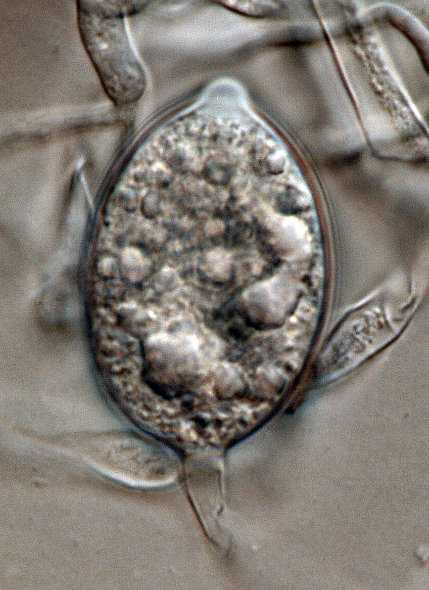   Phytophthora nicotianae nbsp;(CPHST BL 44, selected specimen) asexualnbsp;phase:nbsp;papillatednbsp;sporangium; photonbsp;by Gloria Abad, USDA-APHIS-PPQ. 

