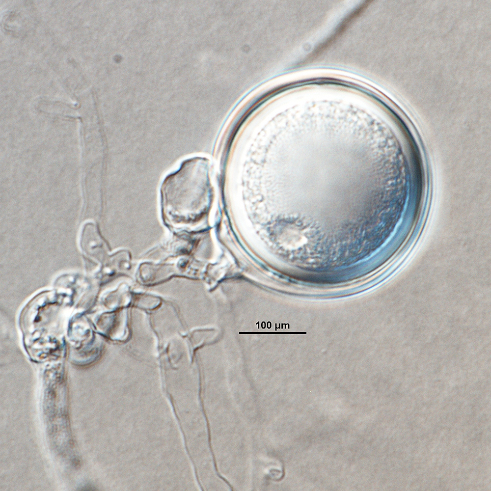  Phytophthora pini nbsp;(ex-type CPHST BL 48) sexual phase formed on V8 agar flooded with soil extract: plerotic oospore in smooth-wall oogonium with paragynous antheridium; photonbsp;by Gloria Abad, USDA-APHIS-PPQ. 
