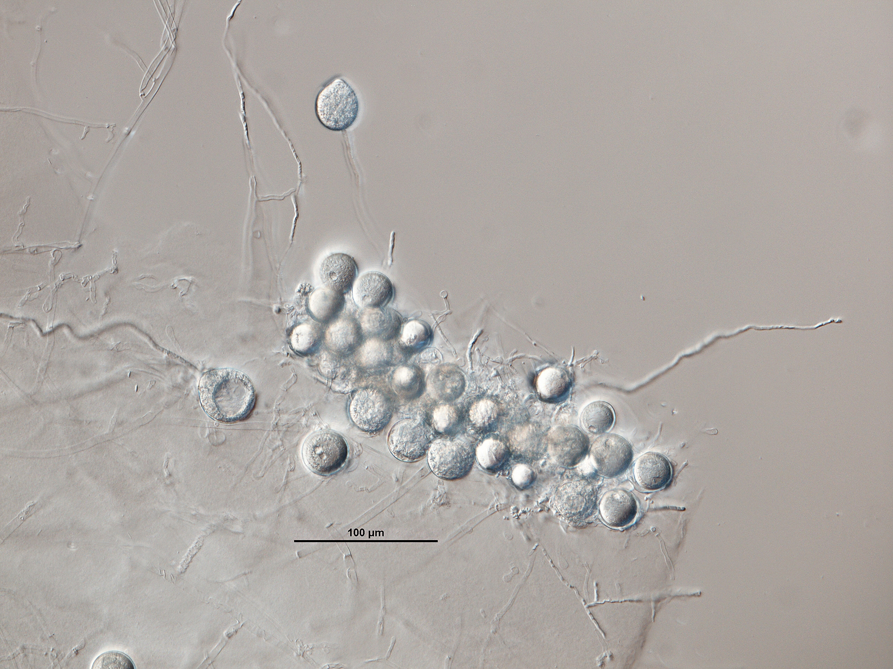   Phytophthora pininbsp; (ex-type CPHST BL 48) asexual phase formed on V8 agar flooded with soil extract:nbsp;sporangium originated in single long sporangiophore, oospores at bottom; photonbsp;by G.Abad, USDA-APHIS-PPQ. 
