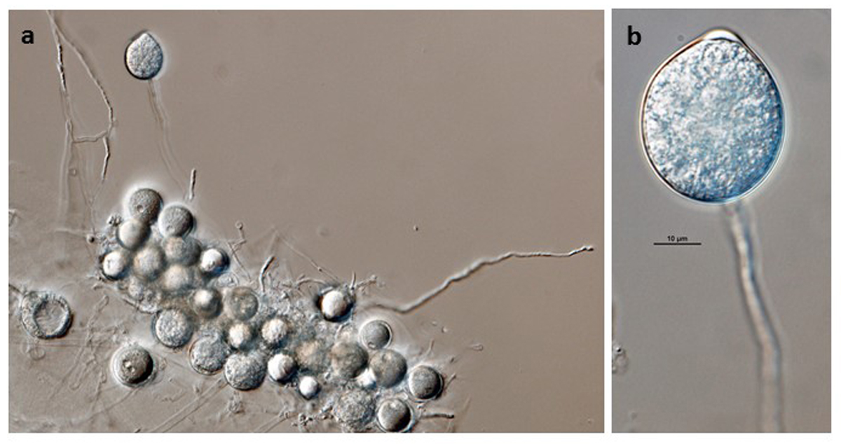   Phytophthora pini  (ex-type CPHST BL 48) asexual phase formed on V8 agar flooded with soil extract: (a) sporangium originated in single long sporangiophore, oospores at bottom, (b) semipapillate persistent sporangium in single long sporangiophore; photos by G.Abad, USDA-APHIS-PPQ. 
