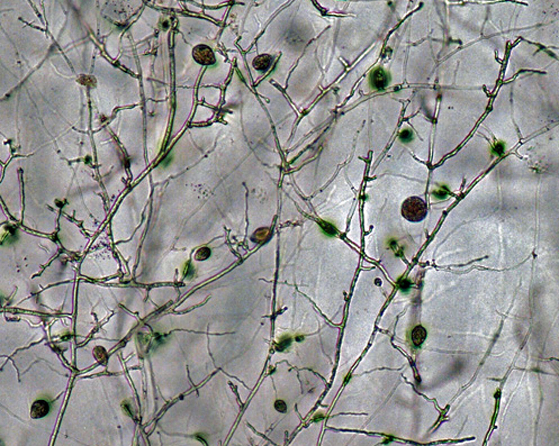   Phytophthora pseudosyringae nbsp;(ex-type CPHST BL 51G) asexual phase:nbsp;sporangia in sporangiophores; photonbsp;by Gloria Abad, USDA-APHIS-PPQ. 
