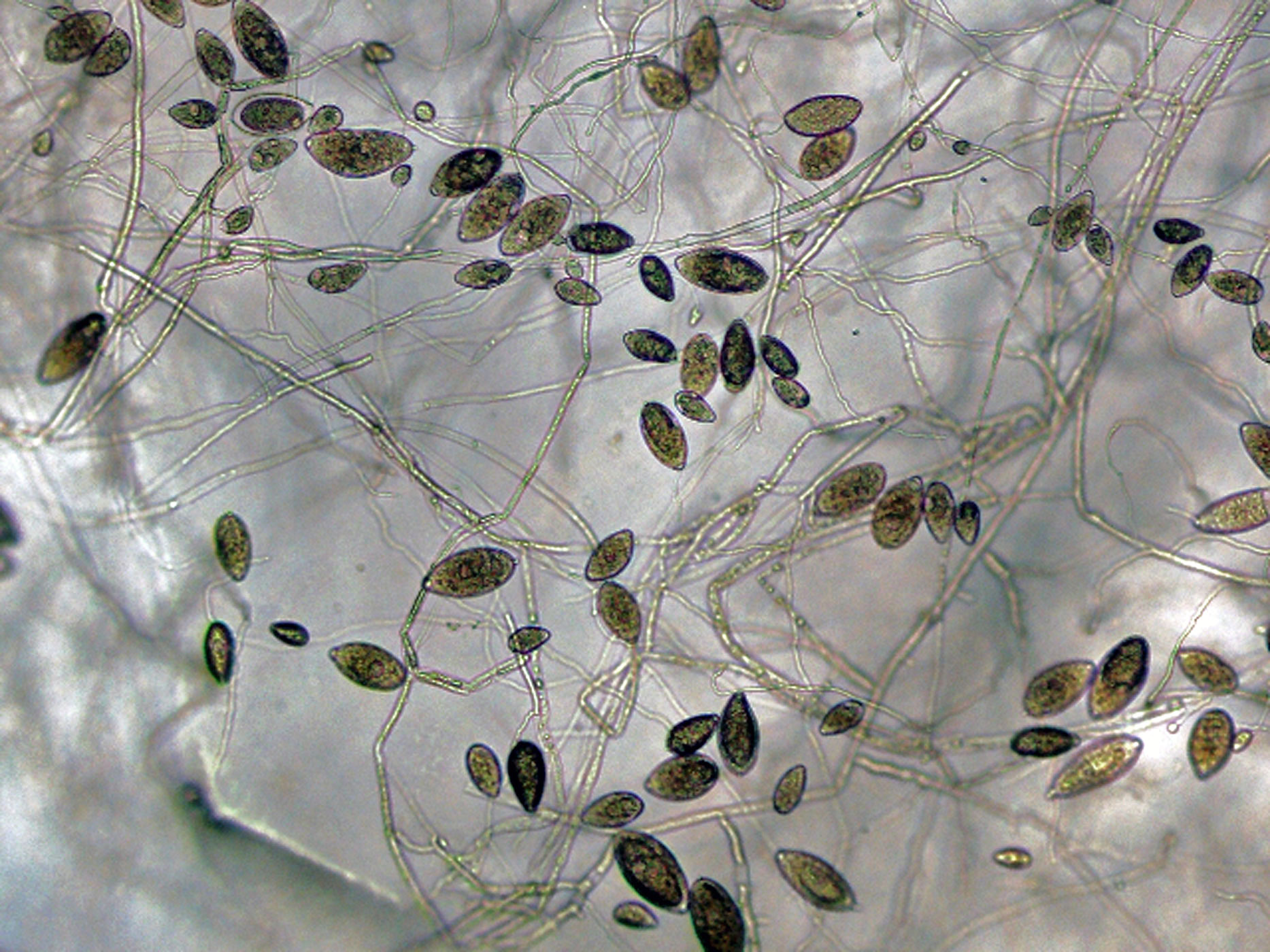   Phytophthora ramorum nbsp;(ex-type CPHST BL 55G) asexual phase: sporangia and sporangiophores; photonbsp;by Gloria Abad, USDA-APHIS-PPQ. 

