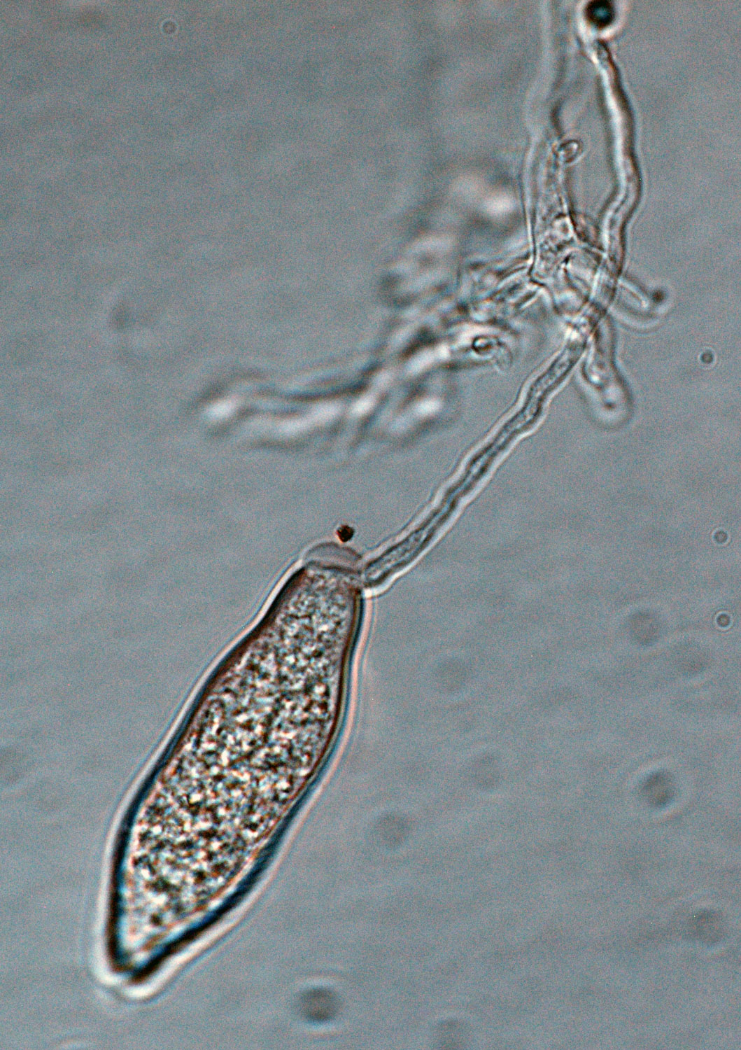   Phytophthora ramorum  (ex-type CPHST BL 55G) asexual phase: semipapillated sporangium with short pedicel; photo by Gloria Abad, USDA-APHIS-PPQ. 
