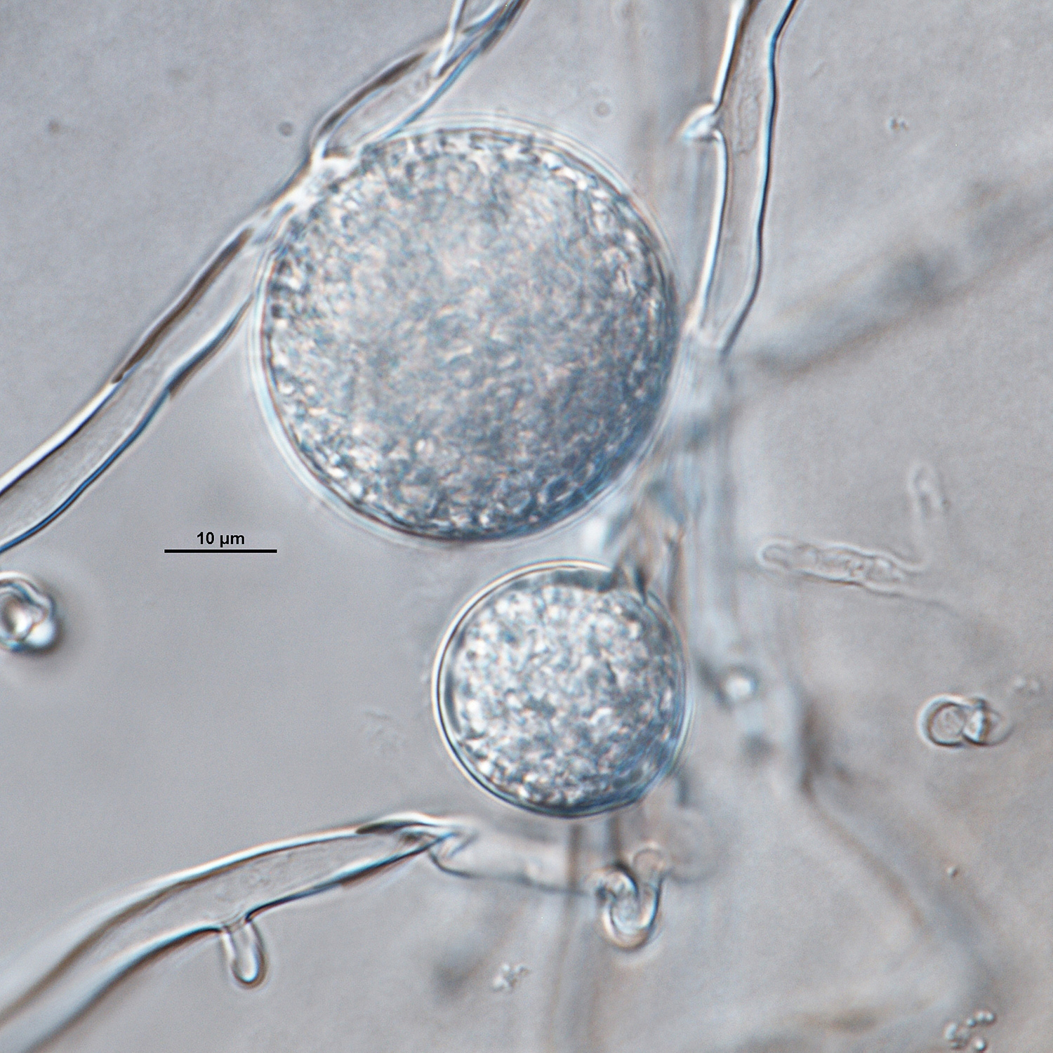   Phytophthora ramorum nbsp;(ex-type CPHST BL 55G) asexual phase:nbsp;intercalary and lateral chlamydospores; photonbsp;by Gloria Abad, USDA-APHIS-PPQ. 
