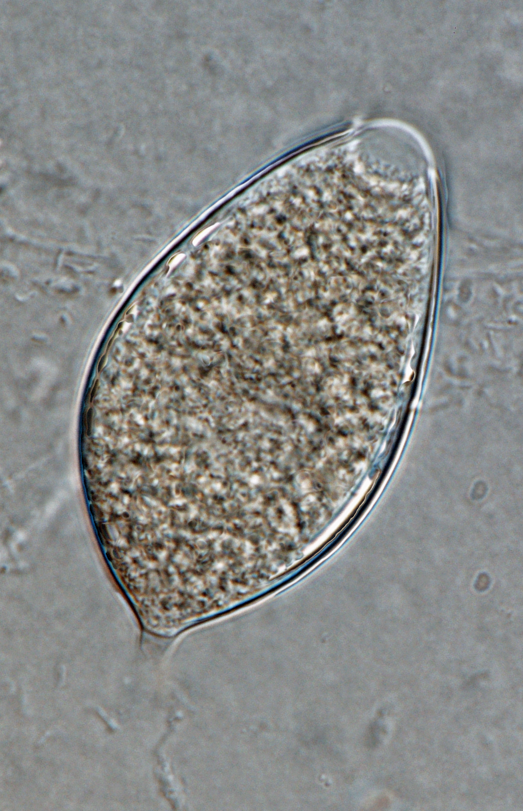   Phytophthora ramorum  (ex-type CPHST BL 55G) asexual phase: semipapillated sporangium with short pedicel; photo by Gloria Abad, USDA-APHIS-PPQ. 
