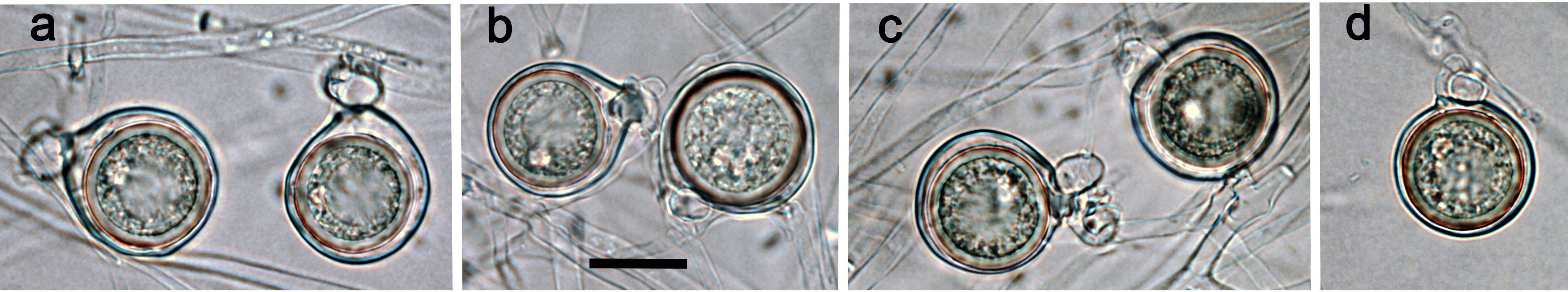  aplerotic oospores of  P .  boodjera  with paragynous antheridia; scale bar = 20 mu;m 
