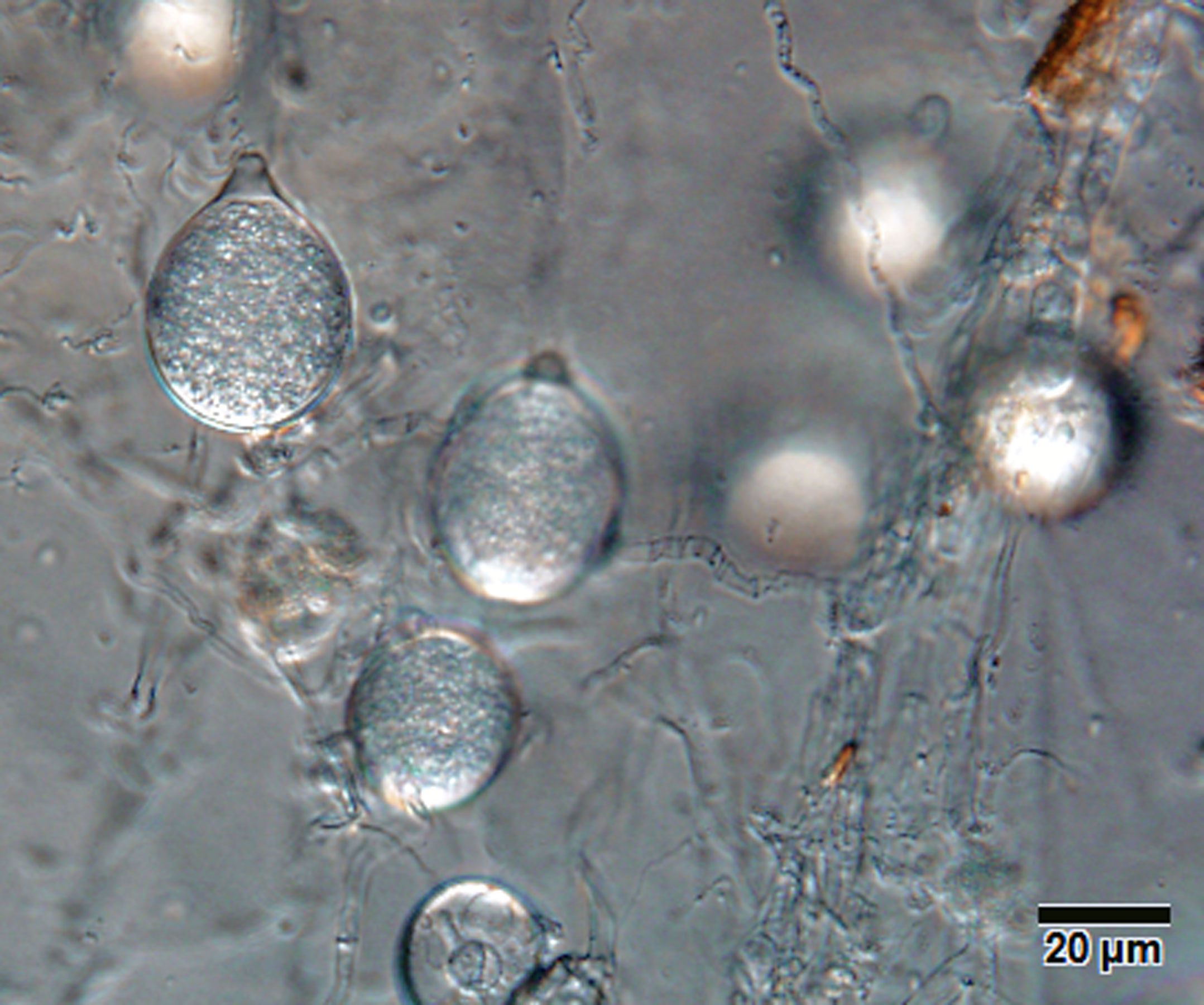  Phytophthora gondwanensis nbsp;(ex-type CBS 139336)nbsp;asexual phase: sporangia papillated, with short pedicel;nbsp;photonbsp;by Lucas A. Shuttleworth, University of Sidney, Australia. 

