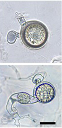  oogonia with smooth walls containing aplerotic oospores; antheridia can be both amphigynous and paragynous mdash; scale bar = 20micro;m 

