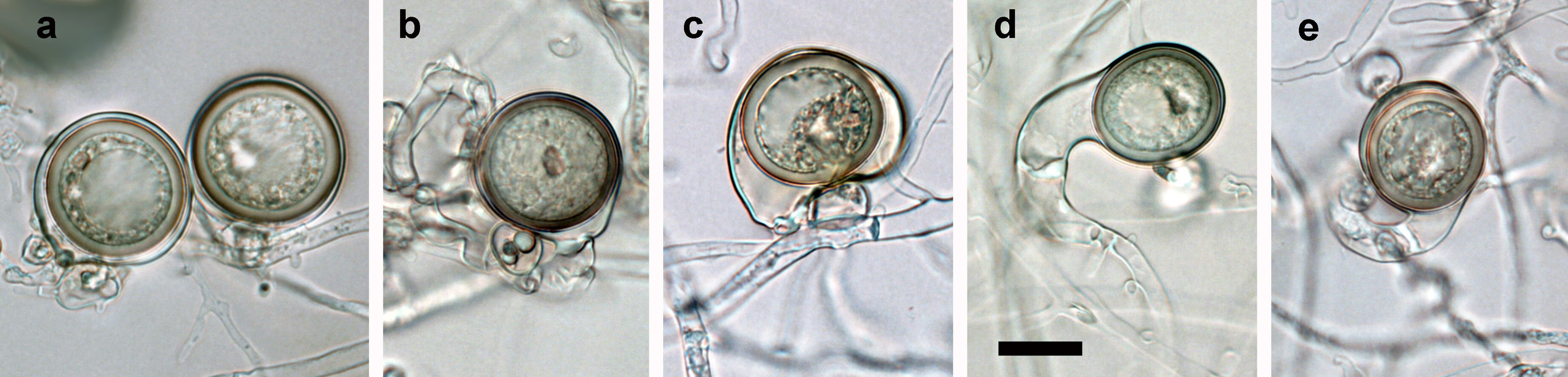  (a) mature oogonia with aplerotic oospore and paragynous antheridium; (b) oogonium with plerotic, slightly golden-brown oospore and paragynous antheridium (c) excentric reniform oogonium with tapering base, markedly aplerotic, slightly golden-brown oospore and paragynous antheridium; (d) oogonium with plerotic oospore and very long thick oogonial stalk; (e) oogonium with plerotic, golden-brown oospore, very long oogonial stalk and paragynous antheridium 
