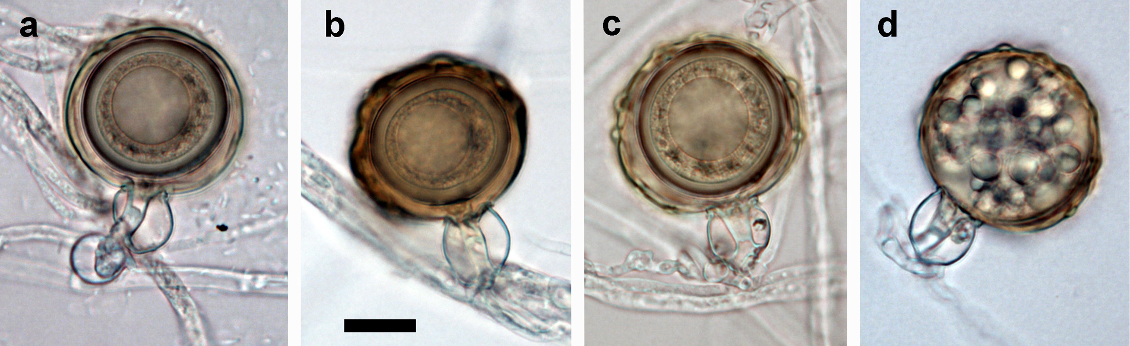  (a-d) mature often bronze-brown oogonia with amphigynous antheridia and thick-walled aplerotic oospores each containing a large ooplast: (a) smooth-walled, (b-c) ornamented gibbose oogonia, (d) gibbose golden-brown oogonium aborted before oospore formation; scale bar = 25 mu;m 
