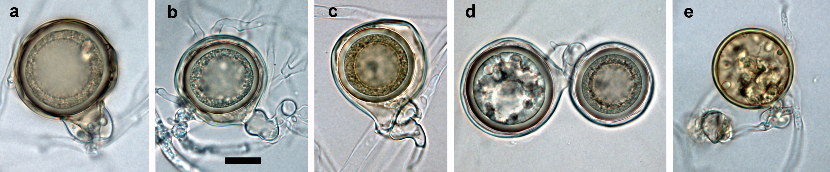   Phytophthora gregata,  mature oogonia containing a thick-walled oospore with a large ooplast (a), nearly plerotic oospore and amphigynous antheridium (b), excentric with tapering base, aplerotic oospore and paragynous antheridium (c), (d) mature oogonia with thick-walled aborted (left) and viable oospore (right), (e) golden-brown aborted oogonium; scale bar = 25 mu;m 
