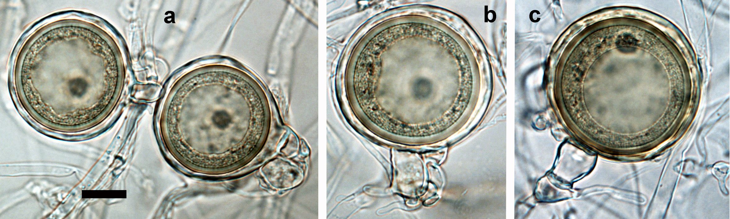  mature, slightly aplerotic to nearly plerotic bronze-brown oospores each containing a large ooplast and a dark nucleus, with paragynous antheridia (a-c) ; scale bar = 25 micro;m 
