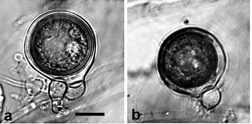  oogonia with wavy walls containing aplerotic oospores, with large ooplasts which turn pale brown on maturity; antheridianbsp;exclusively paragynous, generally situated adjacent to the oogonial stalk; scale bar = 25micro;m 
