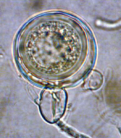   Phytophthora glovera nbsp;(CPHST BL 36) sexual phase of the ex-type: smooth oogoniumnbsp;with aplerotic oosporenbsp;andnbsp;amphigynousnbsp;antheridium; photo by Gloria Abad, USDA-APHIS-PPQ. 
