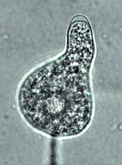   Phytophthora glovera nbsp;(CPHST BL 36) asexual phase of the ex-type: obpyriform semipapillate persistent sporangium; photonbsp;by Gloria Abad, USDA-APHIS-PPQ. 
