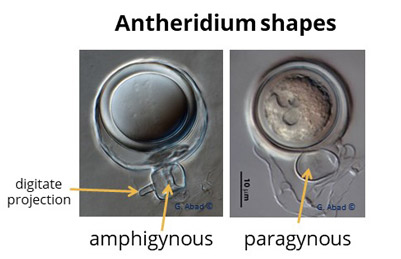 Phytophthora antheridium