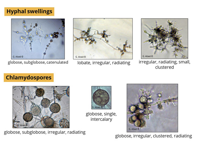 Phytophthora hyphal swellings and chlamydospore
