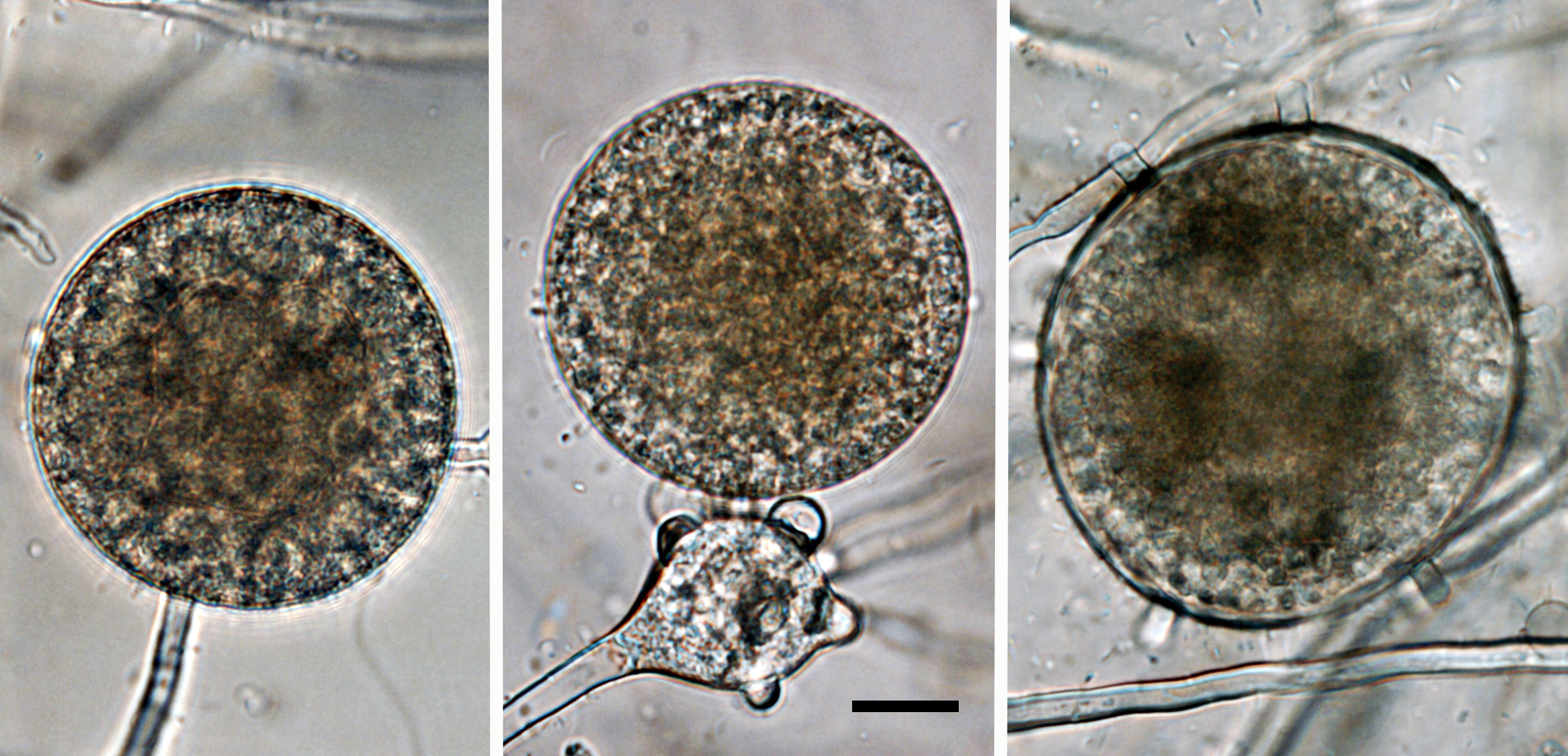  large chlamydosporesnbsp;common; scale bar = 20micro;m 
