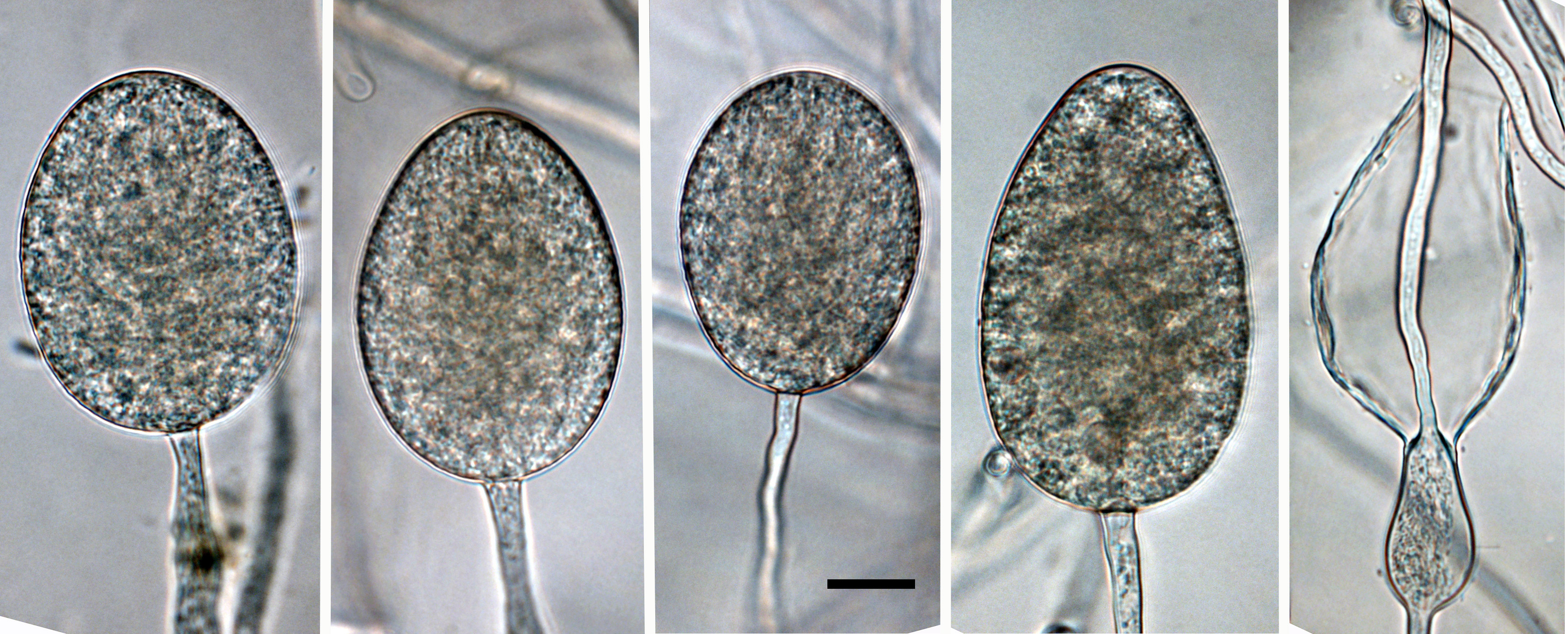  persistent, non-papillate, predominantly ovoid sporangia; scale bar = 20micro;m 
