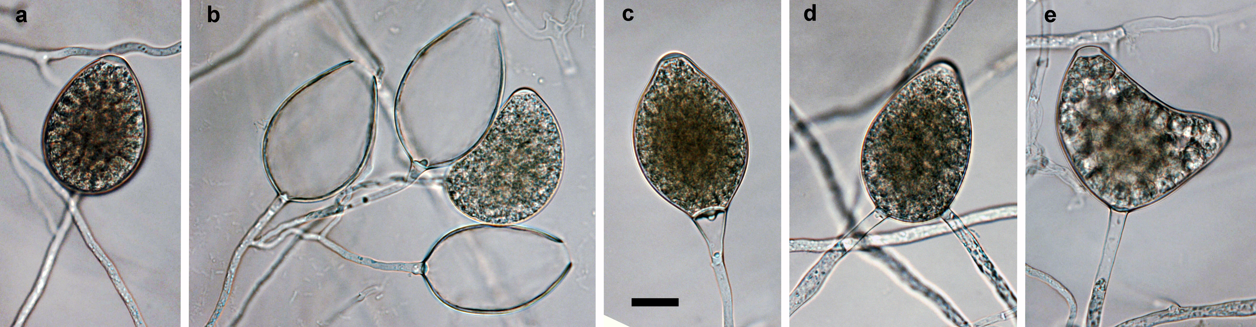 mature semipapillate sporangia formed on V8 agar flooded with soil extract: (a) ovoid, (b) laterally inserted mature sporangium with markedly curved apex, and dense sympodium of empty ovoid sporangia, (c) limoniform with tapering base, (d) ovoid, intercalary inserted, (e) bipapillate mature sporangium; scale bar = 25 mu;m; photos by T. Burgess, Centre for Phytophthora Science and Management, Murdoch University, Australia 
