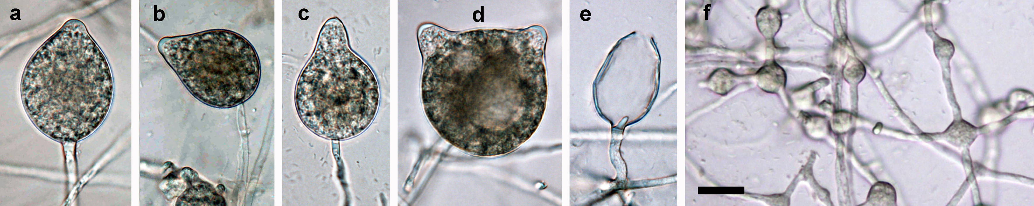  papillate sporangia formed on V8 agar flooded with soil extract:nbsp;(a) ovoid; (b) ovoid, sporangiophore laterally attached; (c) obpyriform, with pointed apex; (d) bipapillate, with large vacuole; (e) empty ovoid sporangium after release of zoospores; (f) catenulate, globose to subglobose hyphal swellings, some with radiating hyphae; scale bar = 25 micro;m 
