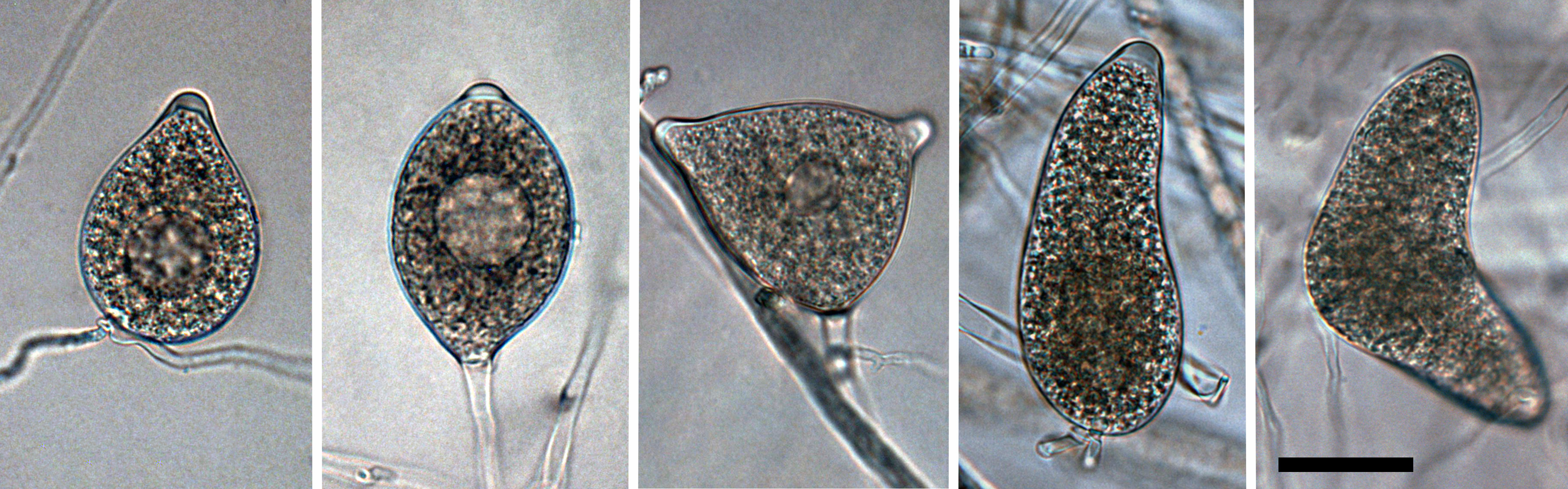  papillate to semi-papillate often bipapillate persistent sporangia; scale bar = 25micro;m 
