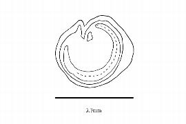   Embryo:   Achatocarpus pubescens ; Illustration by K. Parker, Kirkbride et al. (2006)
