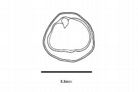   Embryo:   Akania lucens ; Illustration by K. Parker, Kirkbride et al. (2006)
