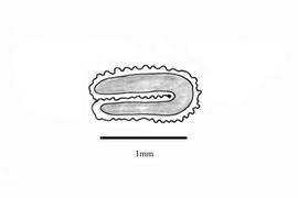   Embryo:   Damasonium minus ; Illustration by K. Parker, Kirkbride et al. (2006) 
