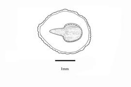  Embryo:  Spigelia anthelmia ; Illustration by K. Parker, Kirkbride et al. (2006)
