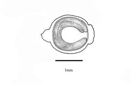   Embryo:   Anredera cordifolia;  Illustration by K. Parker, Kirkbride et al. (2006)
