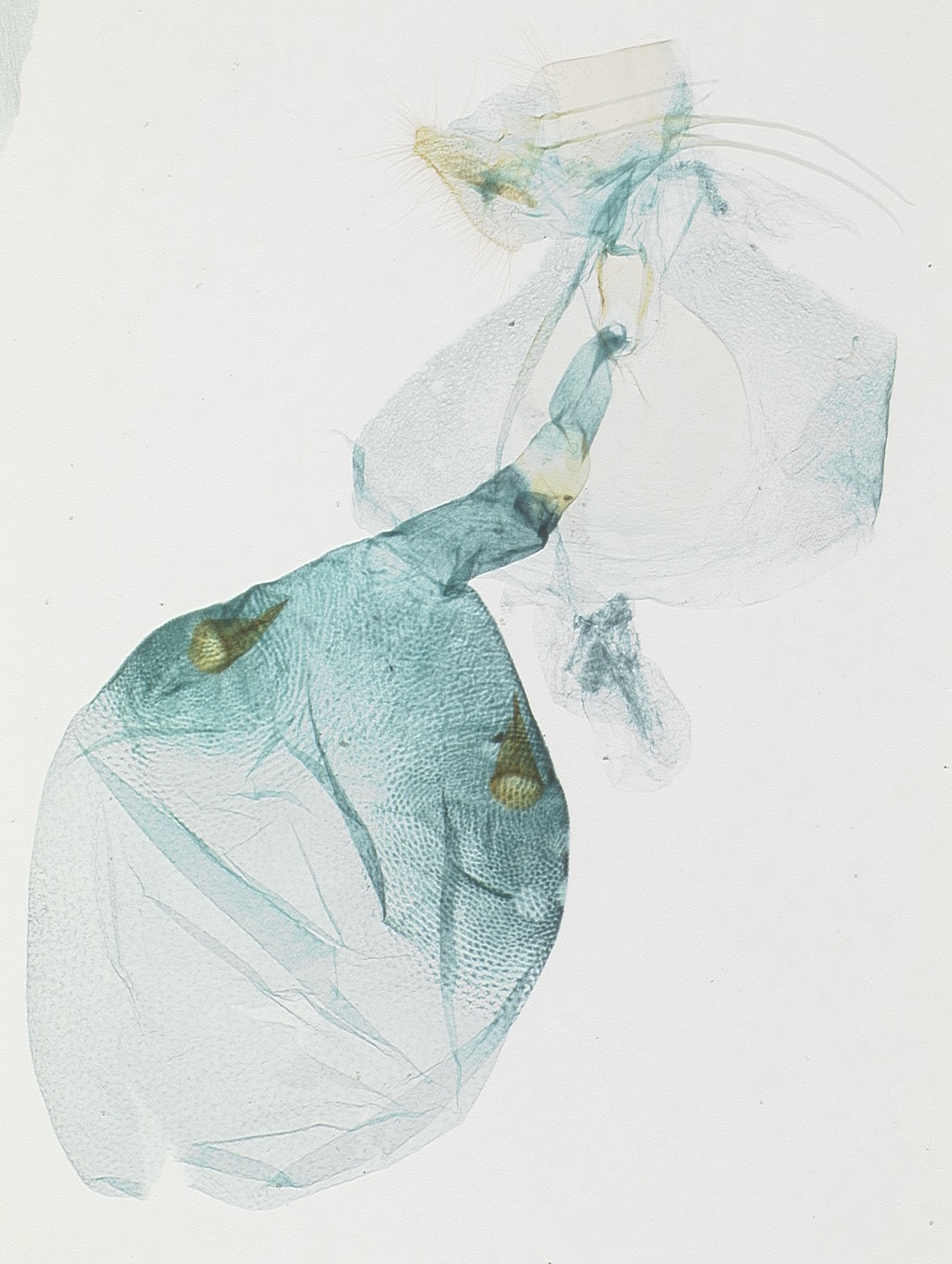 Female genitalia. © Dr. James Hayden, FDACS-DPI. Image used with permission.