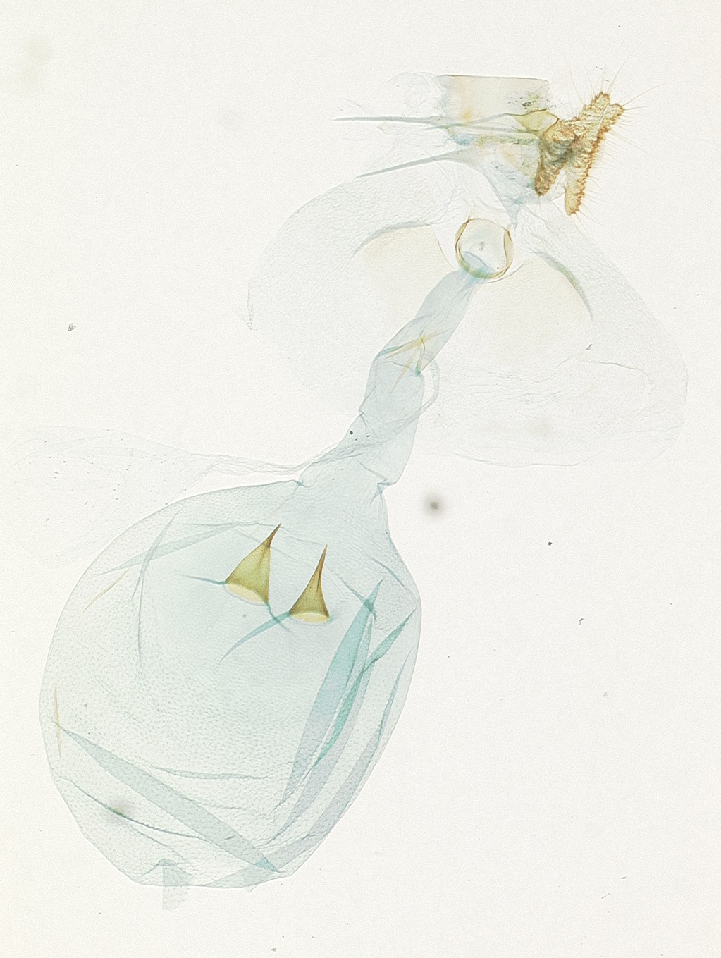 Female genitalia. © James Hayden, FDACS-DPI. Image used with permission.