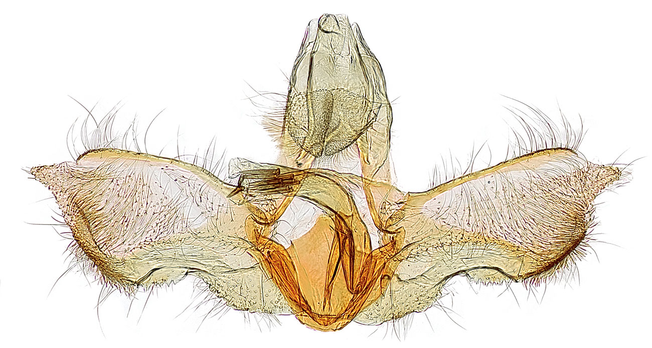 Male genitalia