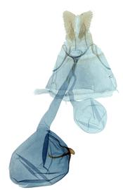  Female genitalia

