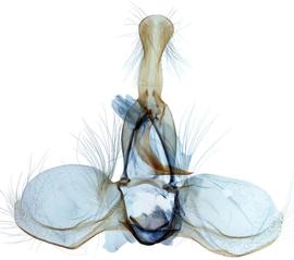  Male genitalia
